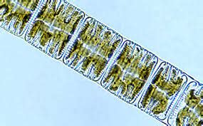  Rhabdonema! Güzelliği ve Karmaşıklığını Keşfetmek İçin Küçük Bir Yolculuk