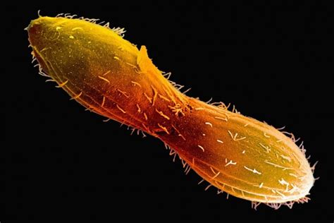  Tetrahymena:  Can You Believe This Tiny Critter Swims Like a Miniature Olympian While Eating Bacteria Like It’s Going Out of Style?