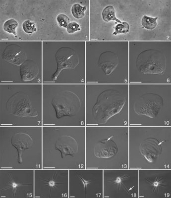  Vannella:  A Microscopic Amoeba That Glimpses a World Beyond Our Perception!